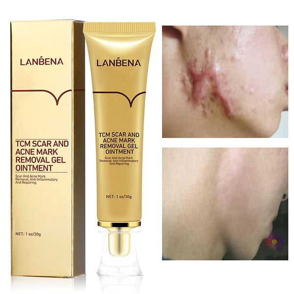 LANBENA Acne and Scar Removal Ointment